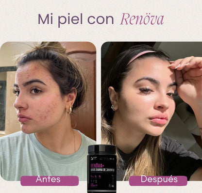 COLAGENO RENOVA+ Rejuvenece, Fortalece y Brilla